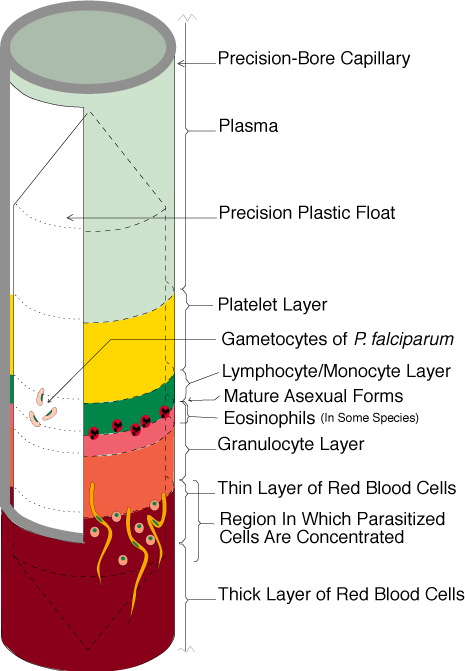 how to use malaria test tube